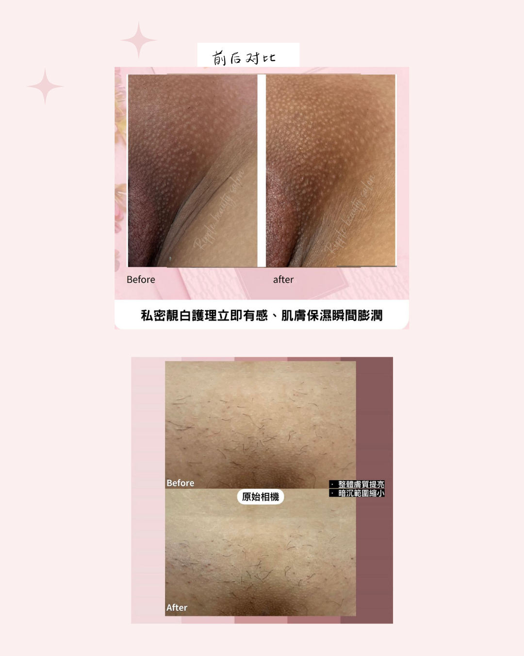 Hydrogel Intimate Mask Instant Bright
